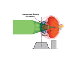 Retinal Physician | PentaVision