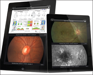 Pacvision Machine Retinal Physician | PentaVision