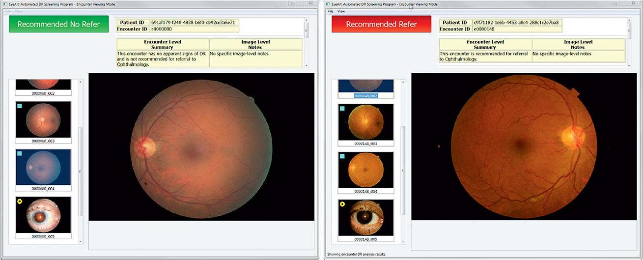 Retinal Physician | PentaVision