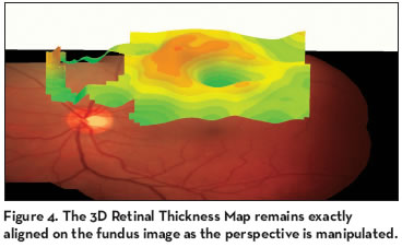 Retinal Physician | PentaVision