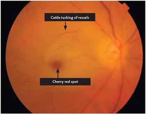 Retinal Physician 