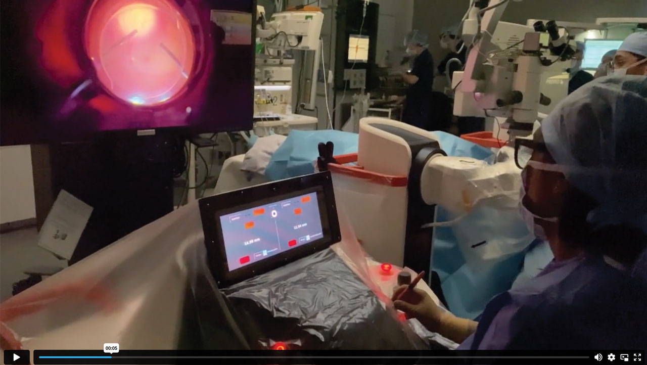 Dr. Fanny Nerinckx performs surgery with the Luca surgical system.