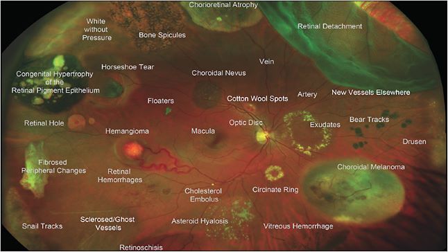 Retinal Physician | PentaVision