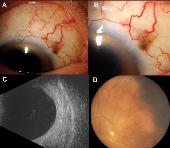 Retinal Physician | PentaVision